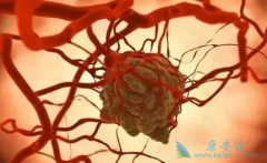 ��˵��֢���Ǿ�֢�ǵ��˰�֢���κ���