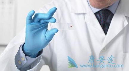 癌症指标 癌症指标