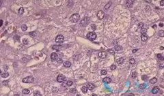 �ΰ�������ǰ֢״��඼�����ž��ҵ���ʹ