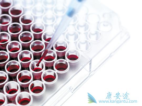 丙肝抗体阳性 丙肝抗体阳性