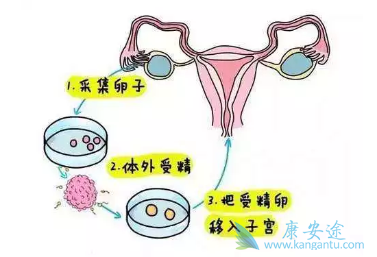 试管婴儿流程 试管婴儿流程