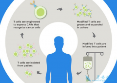 CAR-Tϸ�����Ʒ�������Ҫ����������ϸ�������ͷ��ۺ�֢