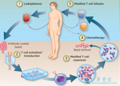 CAR-Tϸ���Ʒ������߶ȸ��Ի���Tϸ����޶����