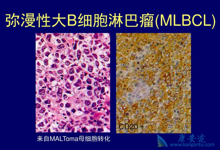 �����Դ�Bϸ���ܰ���