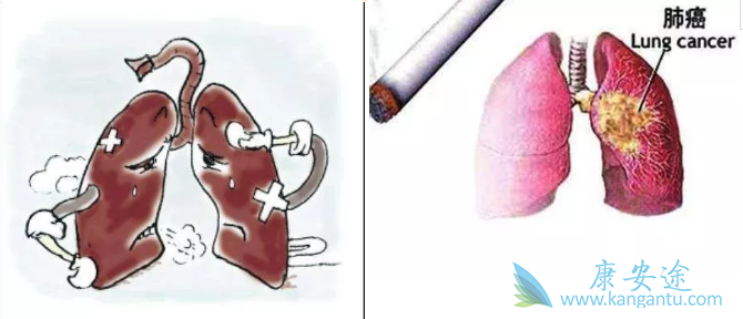 肺癌治疗 肺癌治疗