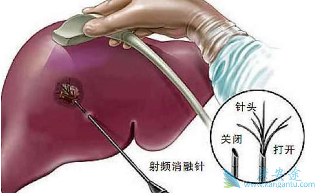乙肝作弊药 乙肝作弊药