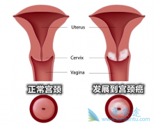 ���ڹ�����֢״�����״��쳣��