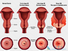 �˽����ڹ�����֢״��������ǰԤ��������