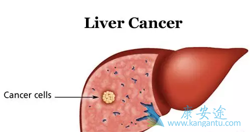 丙肝怎么传染 丙肝怎么传染