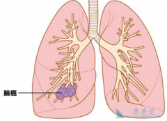 �ΰ������Ѿ�����ȫ���Էΰ���������