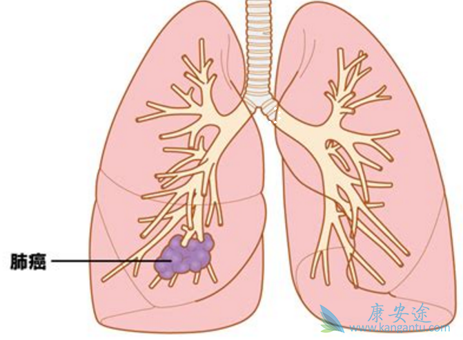 �ΰ�������