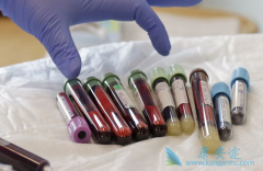 KYMRIAH��ȫ���׸������׼���е�CAR-Tϸ�������Ʒ�