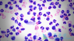 Сϸ���ΰ���ת�Ʒ������ϻ��ƿ����������Ч