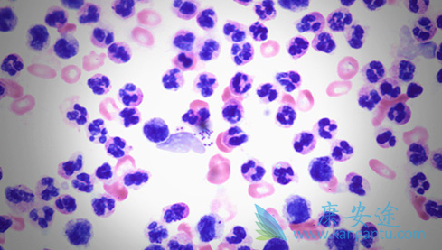 小细胞肺癌 小细胞肺癌