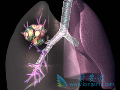 �ΰ����ڻ��߲�����ҩ���Ʒΰ��ɻ���֢״���Ს��