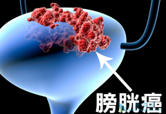 ���ڰ��װ�֢״����Ƶ����ʹ��