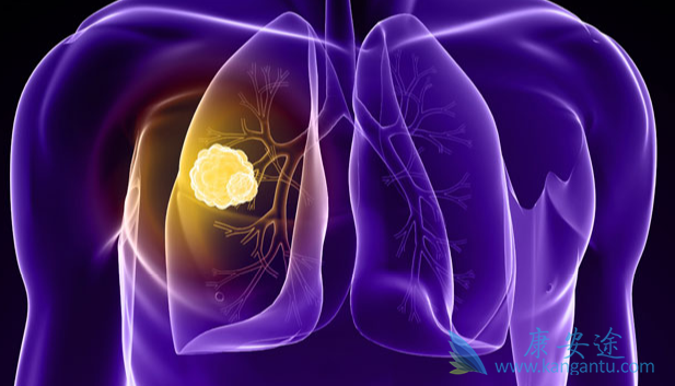 �ΰ���������