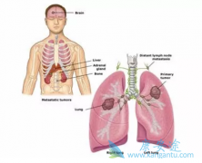 ���ڷΰ����ڻᴫȾ��ĳ�ʶ���������Ҫ�˽�