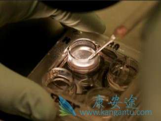 试管婴儿技术 试管婴儿技术