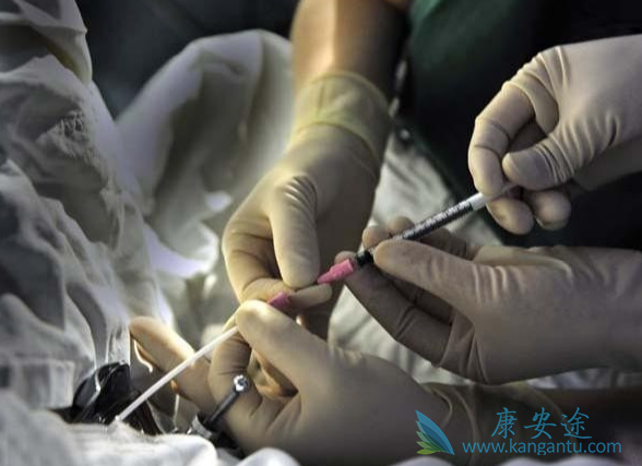 试管婴儿移植后出血 试管婴儿移植后出血