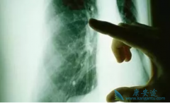 Խ�緢�ַΰ�������֢״Խ�����ڻ��ߵ�����