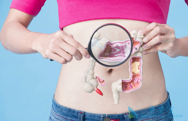 大肠癌症状 大肠癌症状