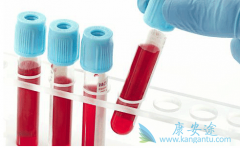 �˽���ε�֢״����Щ�����ڼ�ʱ���Ʊ���