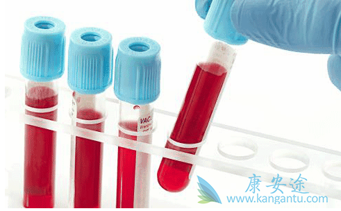 丙肝的症状有哪些 丙肝的症状有哪些