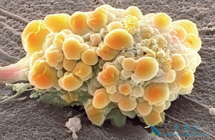 ���˰�֢��ô��