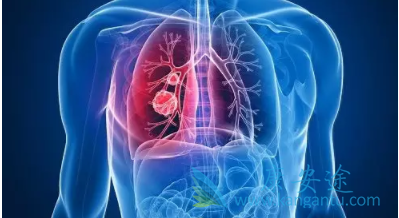 �ΰ�������ǰ֢״