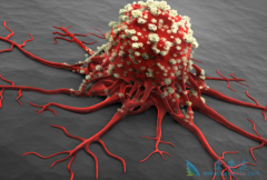 �����ŷ�ɥ���İ�֢������Ϊ��֢�ᴫȾ��