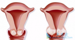 ���ư�֢������֢״����ݲ����ַ���Χ���̷ּ���֢״