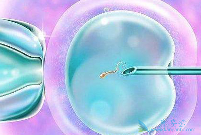 试管婴儿移植后腹痛 试管婴儿移植后腹痛