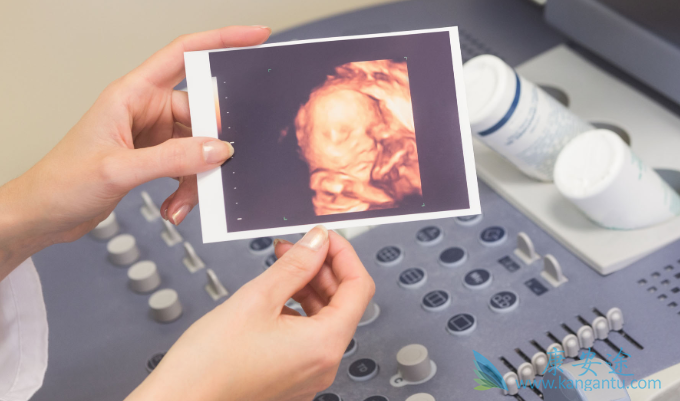 试管婴儿移植后感觉 试管婴儿移植后感觉