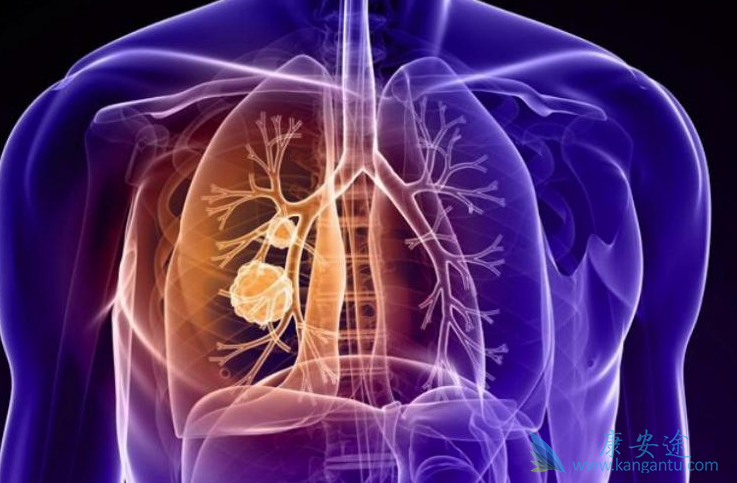 �ΰ���������