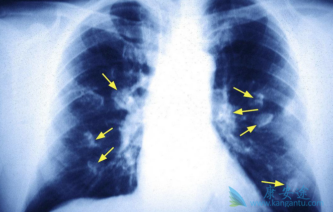 �ΰ���������