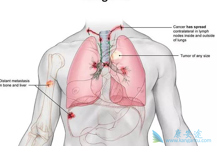 �ΰ����ڻ���