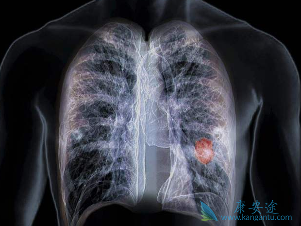 �ΰ����ڻ���