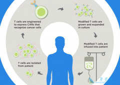 ������CAR-Tϸ�����Ʒ�������Щ�ŵ㣿