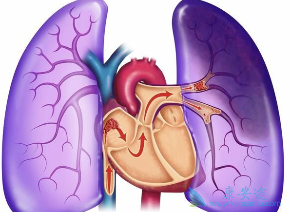 什么是非小细胞肺癌 什么是非小细胞肺癌