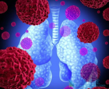 ������Ѫ��һ�������ڷΰ���֢״��