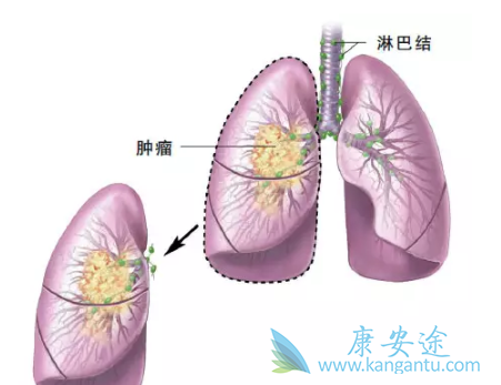 �ΰ�����