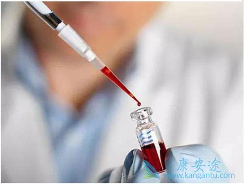 �Űͷΰ�����