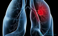 ת���Էΰ������Ʒ�������ѡ����ҽ����