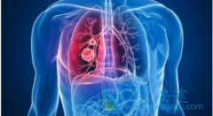 ���˷ΰ���ô�컼��Ҫ�����ȷ���ΰ�