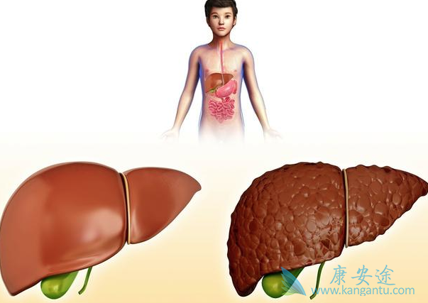 如何治疗丙肝 如何治疗丙肝