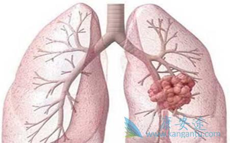 ��Сϸ���ΰ�