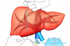 ����Ǳ���ڵ����Ա���֢״����Щ?