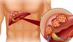 �Ҹ�Я����һ���ᷢչ��Ϊ�Ҹλ�����?