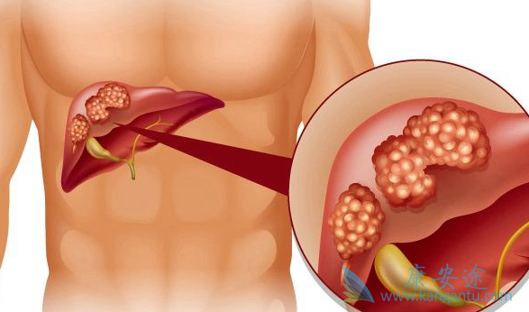 乙肝携带者 乙肝携带者